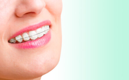 The Types Of Braces Available At Smile Up And Their Benefits