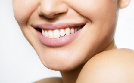 Why Professional Tooth Whitening Is Such A Popular Cosmetic Treatment