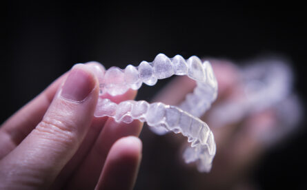 Top 5 reasons To Choose Invisalign To Straighten Your Teeth