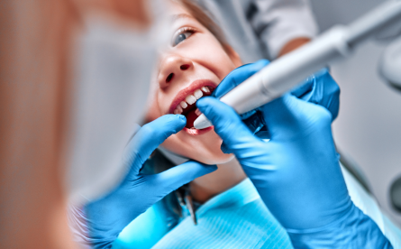 Airflow Teeth Polishing At Smile Up: Minimally-Invasive Alternative To A Scale And Polish