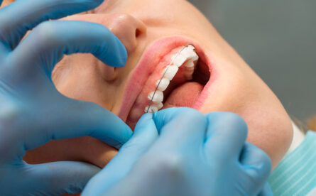 Why An Increasing Number Of Adults Are Having Orthodontic Treatment