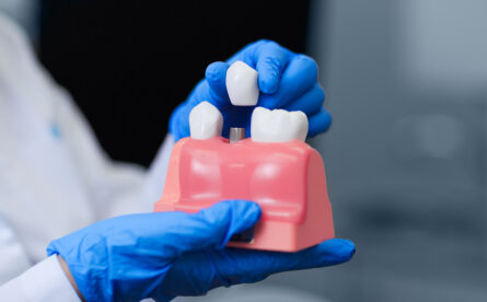 How A Missing Tooth Affects Multiple Aspects of Your Health