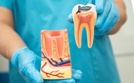 Everything You Need To Know About Root Canal Treatment
