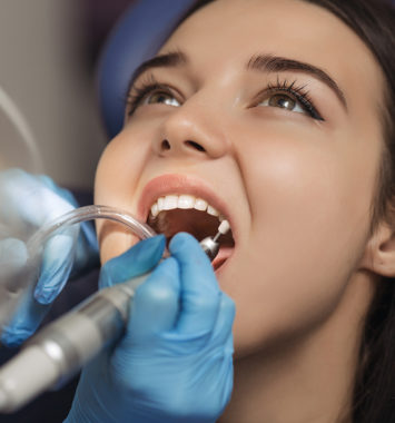 Close-up medical dentist procedure of teeth polishing. Dentist making professional teeth cleaning female young female patient at the dental office. Close-up plan
