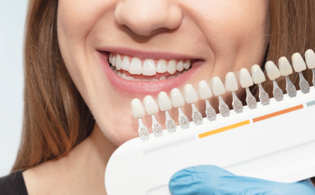 How Teeth Whitening Can Change Your Day-To-Day Life