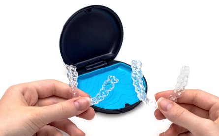 Invisalign’s Growing Popularity With Adult Patients