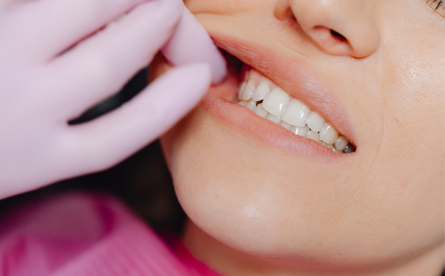 How Stress Affects Teeth