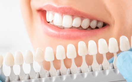Tips For Keeping Your Teeth Looking White