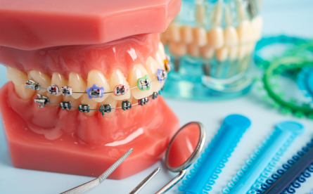 Orthodontics at Smile Up Dental